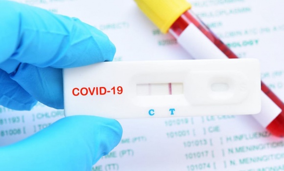 Prevén que en 15 días estarán a la venta los autotest de coronavirus